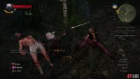 The quicker you slay archers, the easier your life will be.